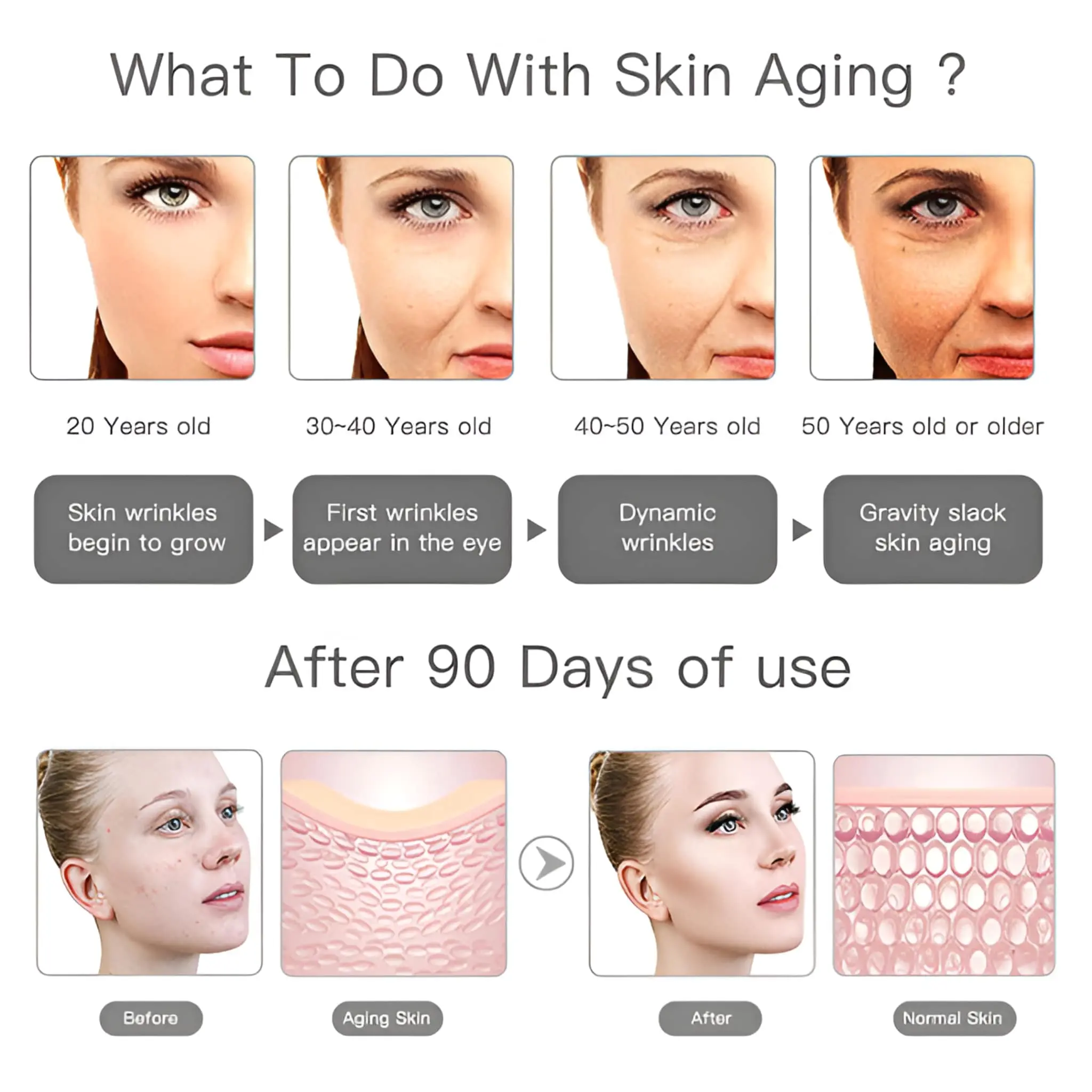 Mini Portable HIFU RF Ultrasonic Anti-Wrinkle Face Lifting Device - Image 6